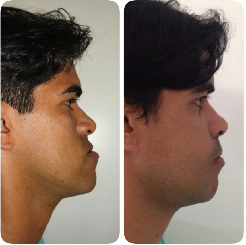 cirurgia-bucomaxilofacial-2