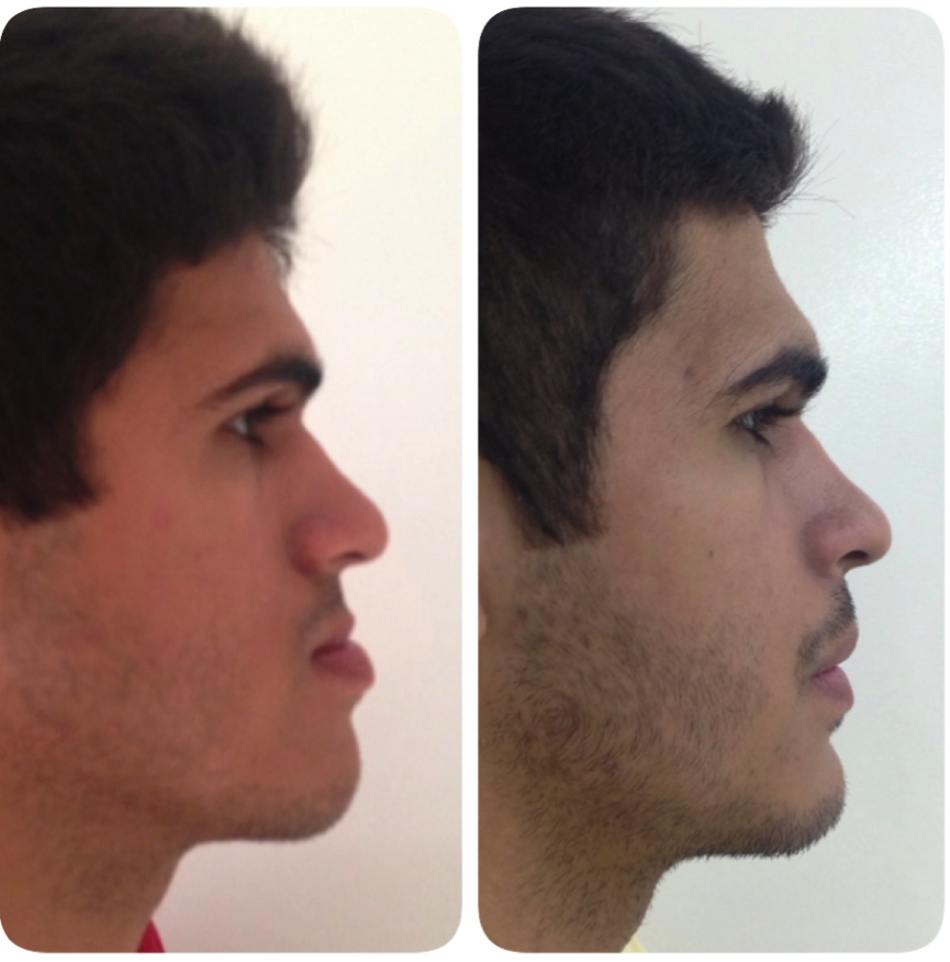 cirurgia-bucomaxilofacial-3