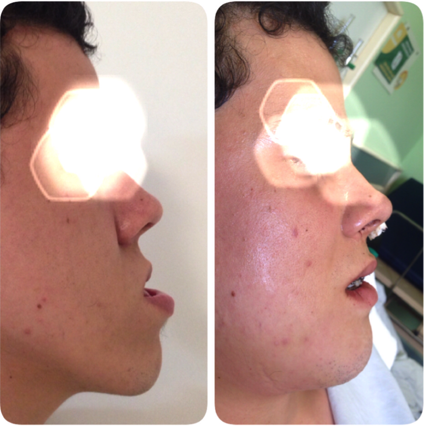 cirurgia-bucomaxilofacial-4