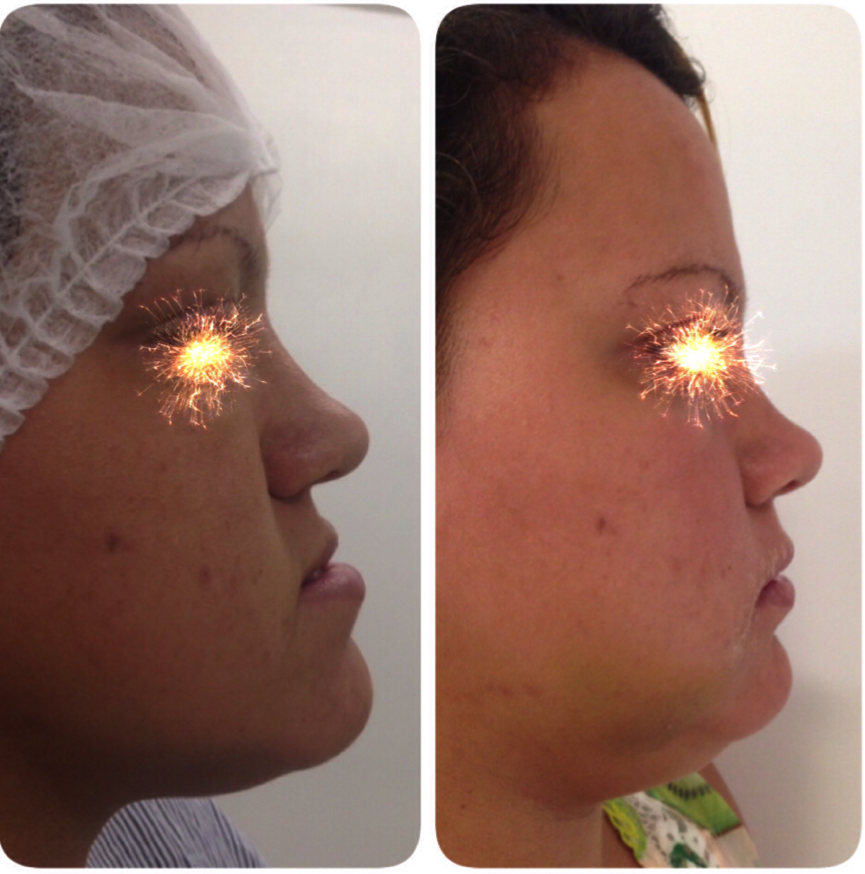 cirurgia-bucomaxilofacial-5